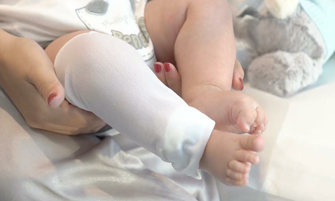 Could Wet Wrap Therapy be the Answer to Kids’ Eczema Flare-ups?